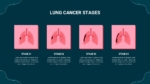 Stages of Lung Cancer Slide For Presentation