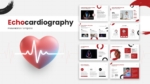Echocardiography Presentation Template for PowerPoint and Google Slides