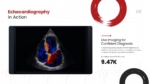 Echocardiography in Action Template for PowerPoint and Google Slides