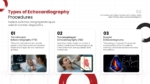 Types of Echocardiography Procedures PowerPoint and Google Slides