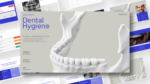 Dental Hygiene Case Study presentation template featuring a 3D dental jaw model, clean clinical layout, and editable slides for patient assessments, treatment planning, radiographs, and oral health case presentations in PowerPoint and Google Slides.
