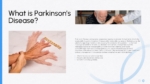 Presentation slide explaining what Parkinson’s disease is with medical images and supporting information